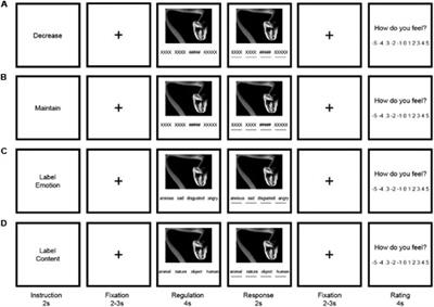 Second <mark class="highlighted">Language Use</mark> Facilitates Implicit Emotion Regulation via Content Labeling